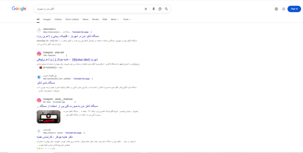 انالیز بدن در شهریار